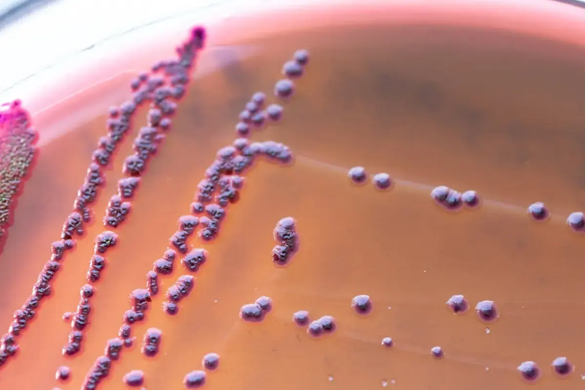 Gut Bacteria Linked to Pre-Illness Fatigue