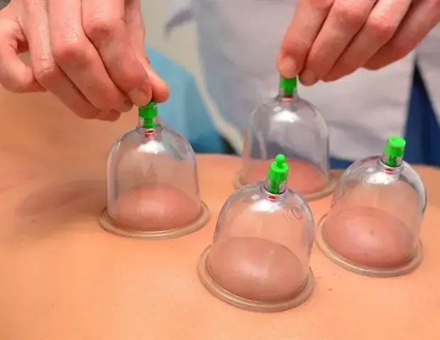 New Method Uncovers Skin Secrets During Cupping Therapy