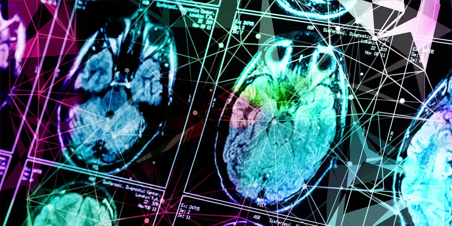 How Childhood Trauma Alters Brain Structure